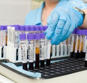 prise de sang pour diagnostiquer des douleurs articulaires