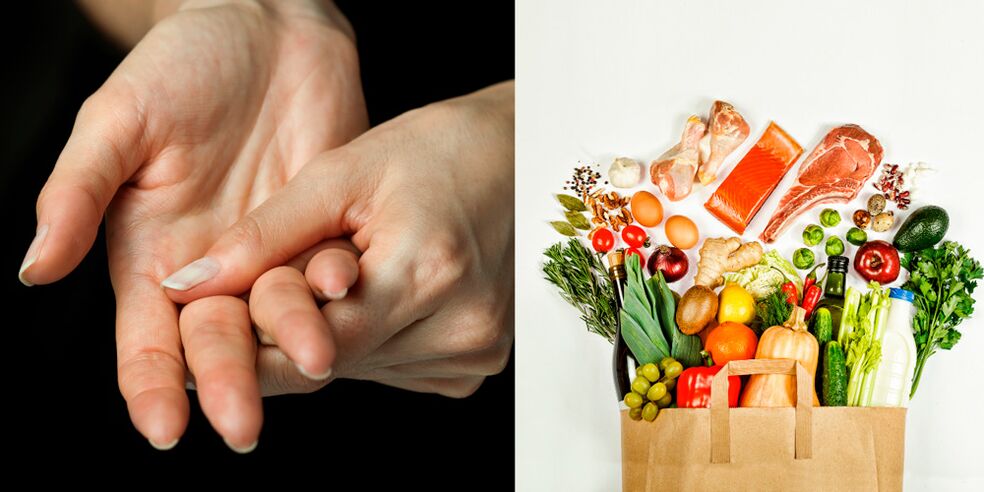 arthrite goutteuse des mains et aliments pour la traiter