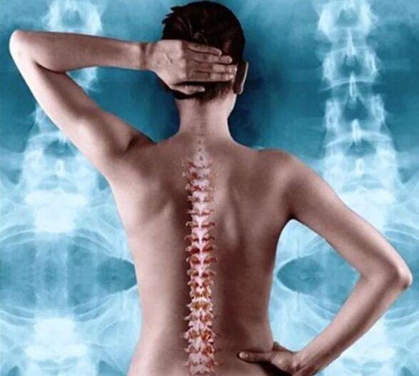 ostéochondrose spinale et thoracique
